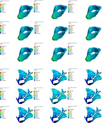 Quantifying the effects of five rehabilitation training methods on the ability of elderly men to control bowel movements: a finite element analysis study